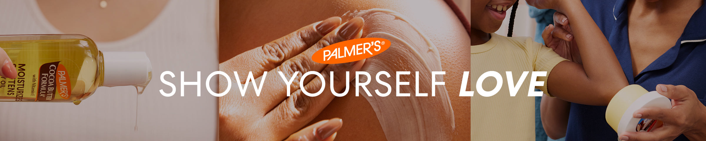 Palmer's