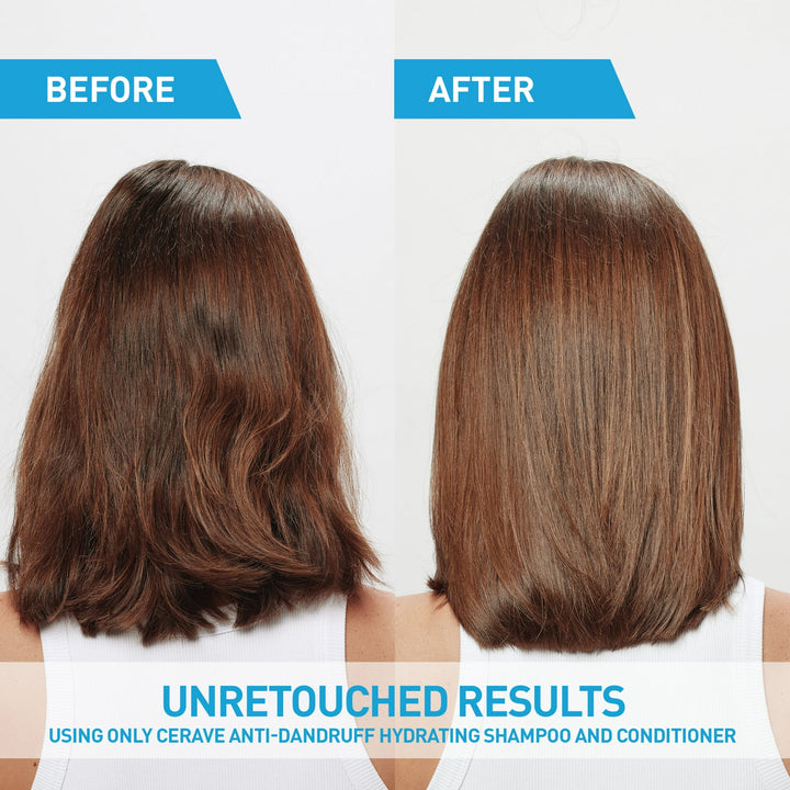 CeraVe Anti-Dandruff Hydrating Conditioner