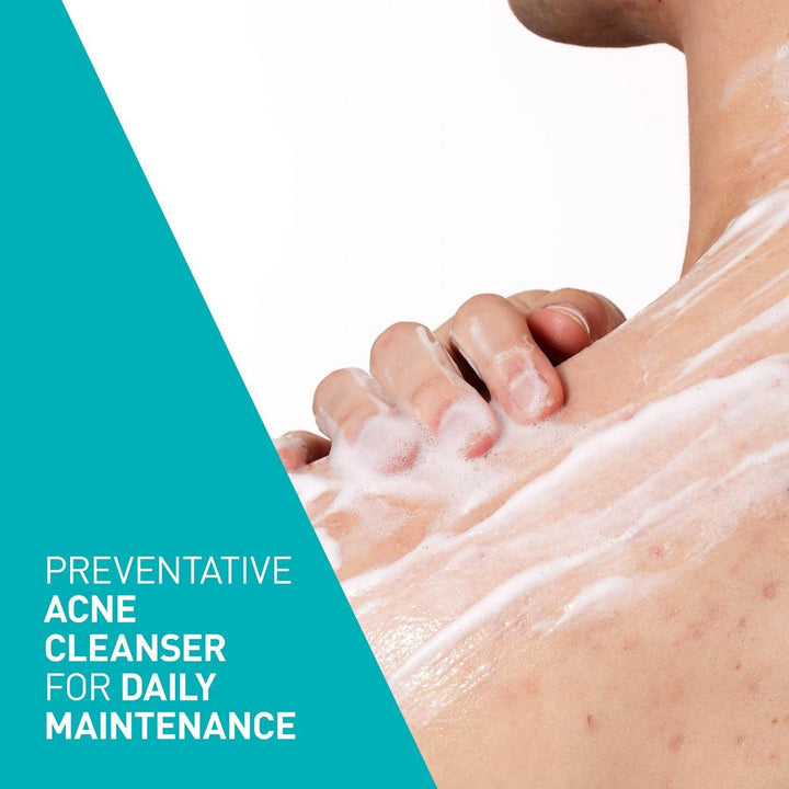 CeraVe Acne Foaming Cream Cleanser