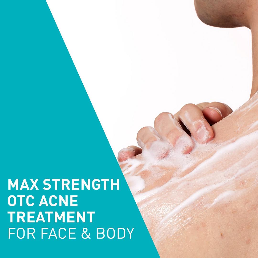 CeraVe Acne Foaming Cream Wash