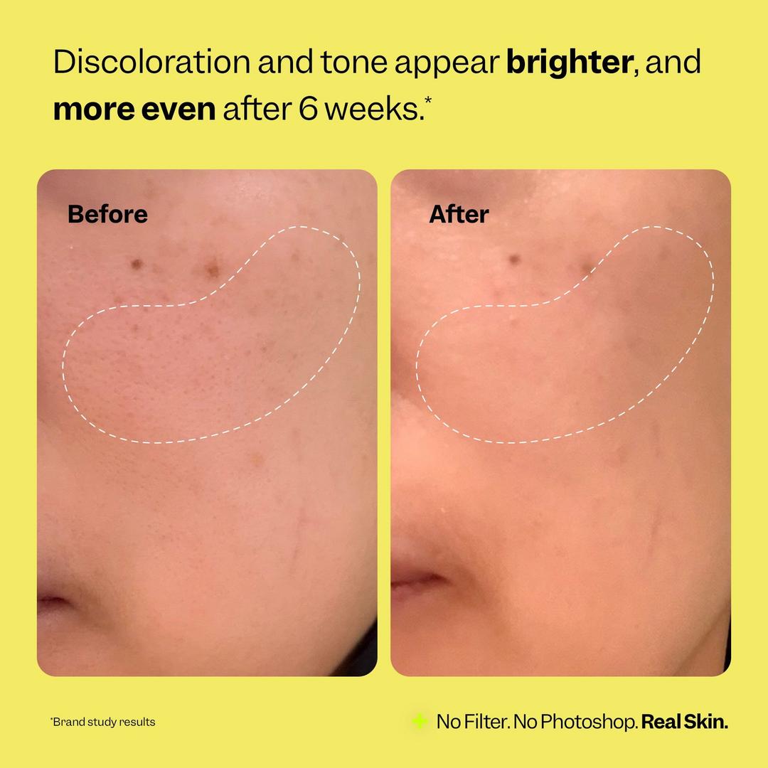 Peach Slices Super Fade Discoloration Serum