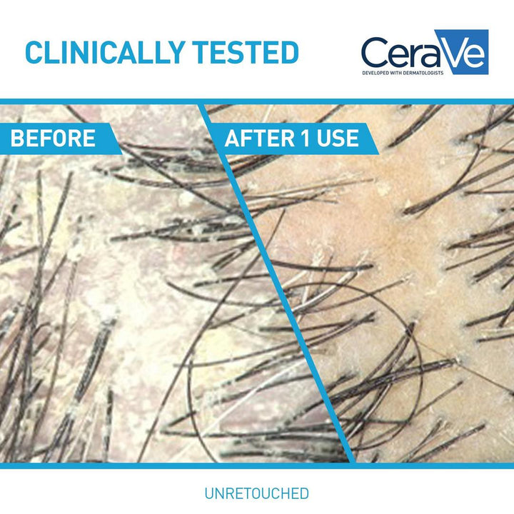 CeraVe Anti-Dandruff Hydrating Shampoo