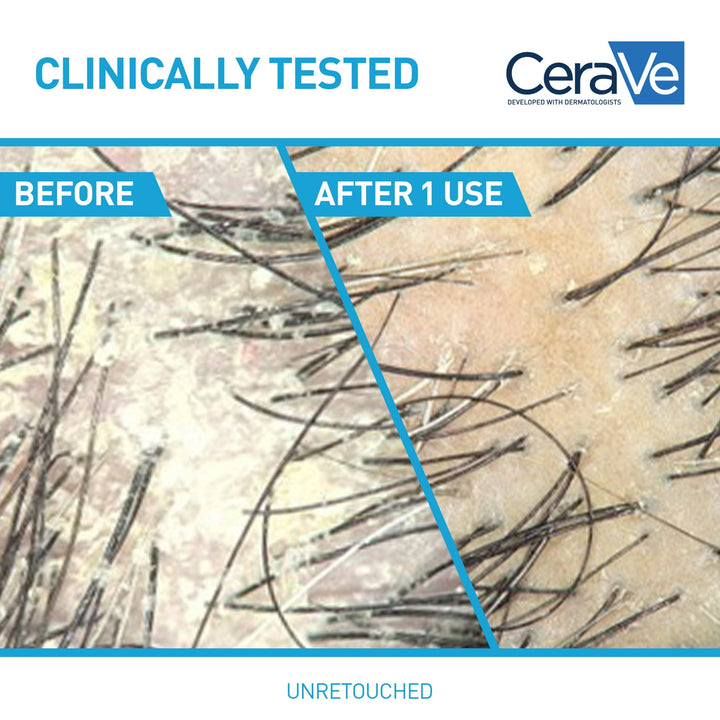 CeraVe Anti-Dandruff Hydrating Conditioner