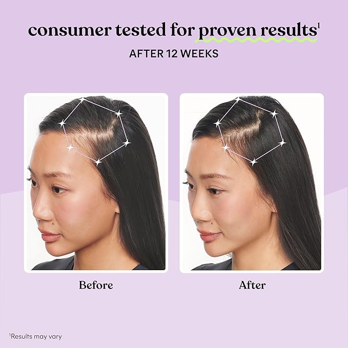 Lemme Grow Haar & Hoofdhuid Supplement