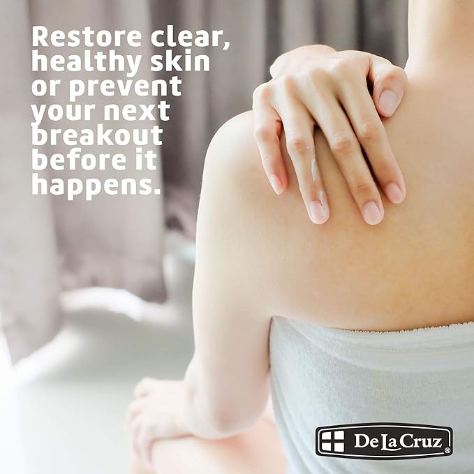 De La Cruz - Acnebehandelingszalf - 73,7 g