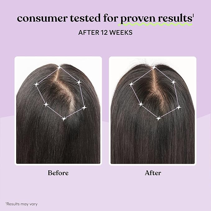 Lemme Grow Haar & Hoofdhuid Supplement