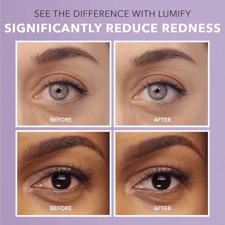 Lumify Eye Drops
