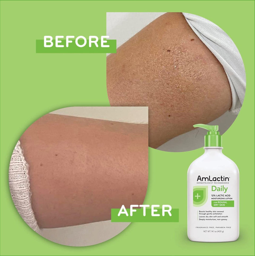 AmLactin - Daily Nourish Lotion with 12% Lactic Acid AHA - 400g