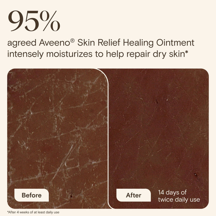Aveeno Skin Relief Healing Ointment for Dry Sensitive Skin