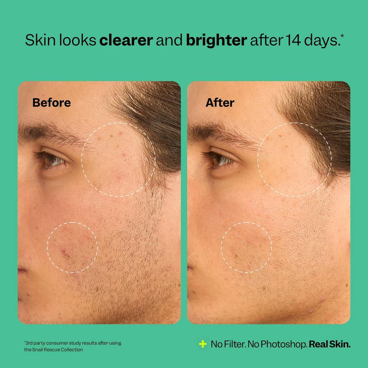 Peach Slices Snail Rescue Blemish Busting Toner