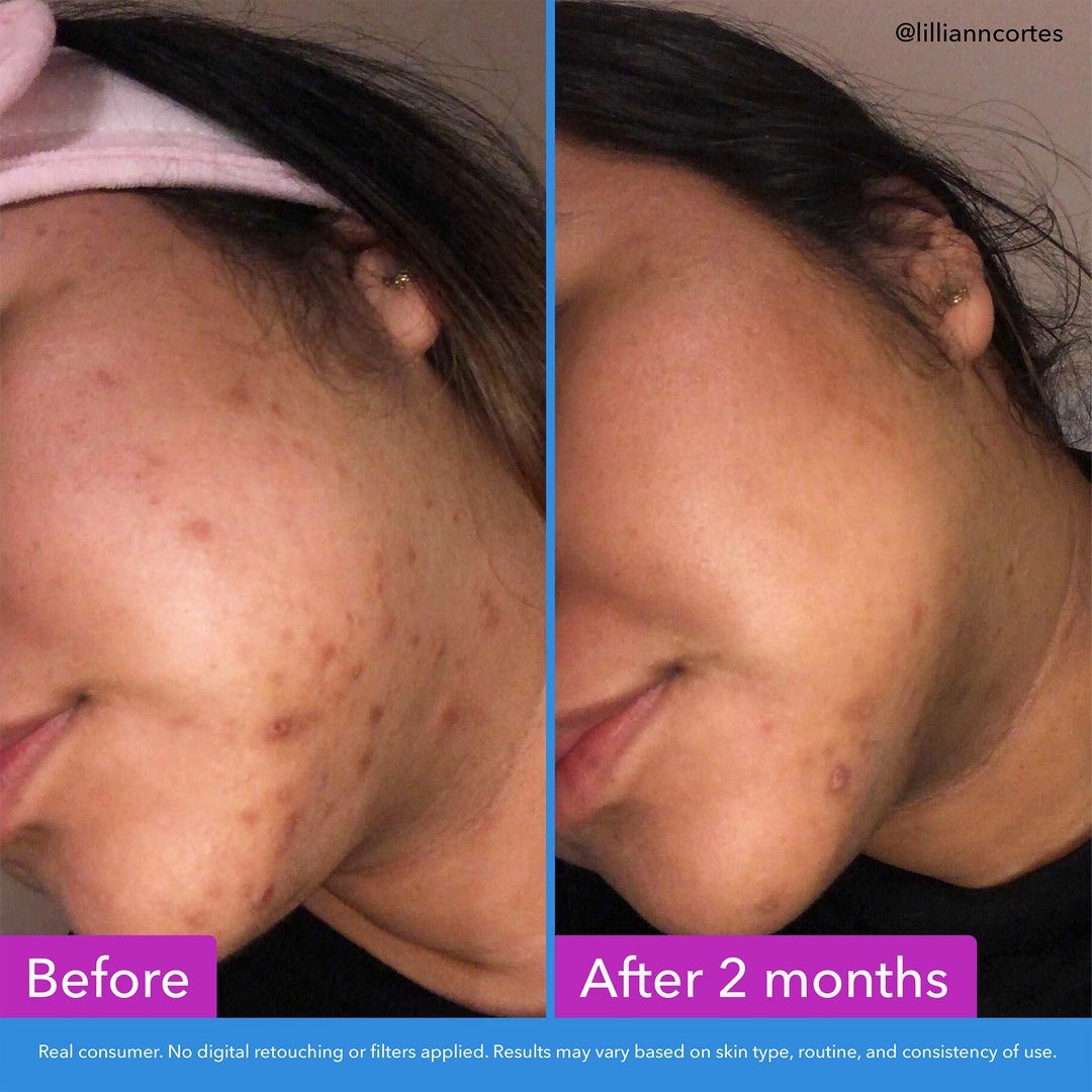 Good Molecules Discoloration Correcting Serum