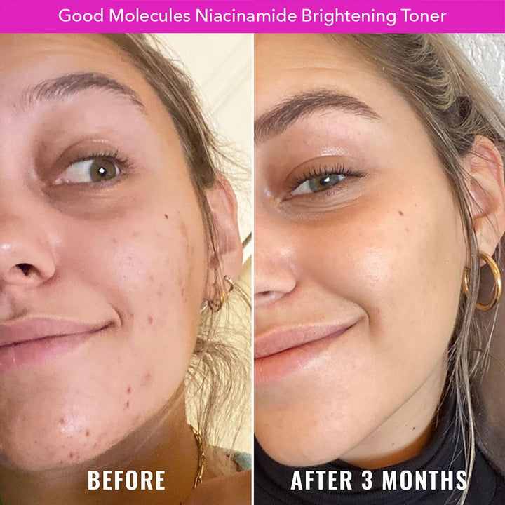 Good Molecules Niacinamide Brightening Toner