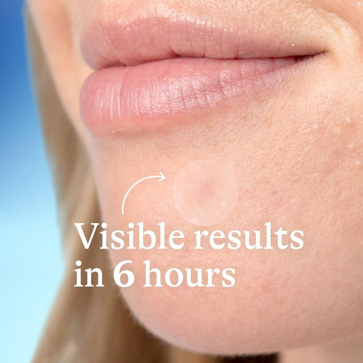 Differin Acne Prone Skin Patches