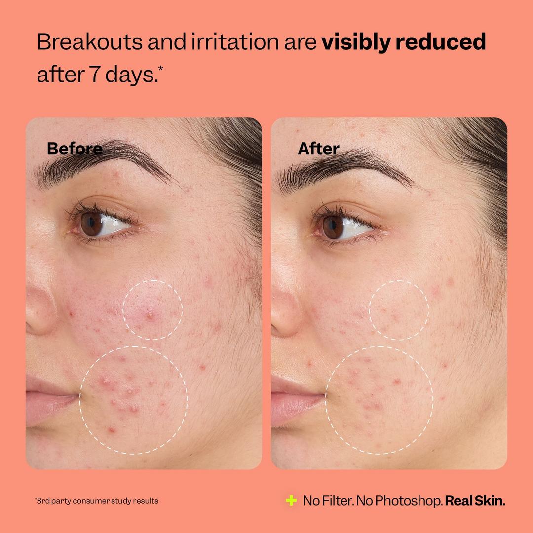 Peach Slices Fix All Recovery Spray