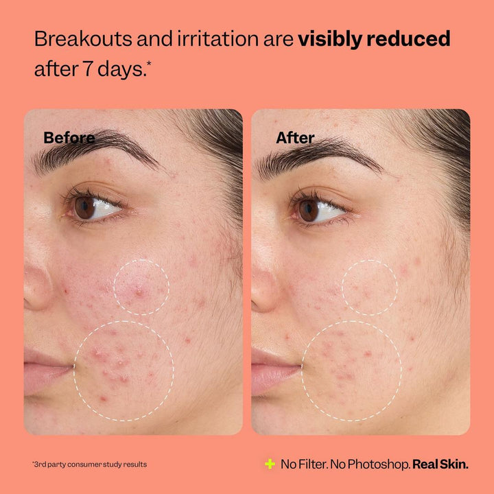 Peach Slices Fix All Recovery Spray