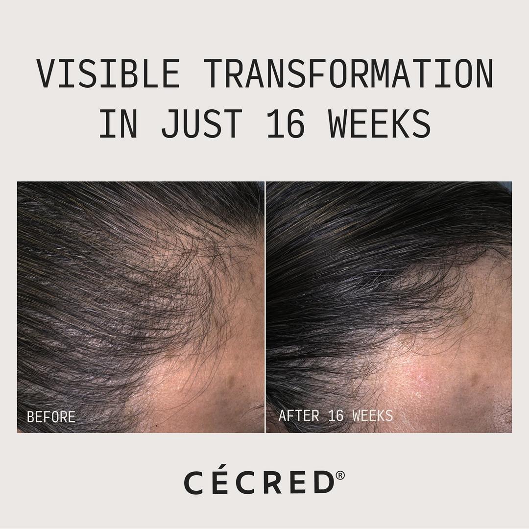 CÉCRED Restoring Hair & Edge Drops