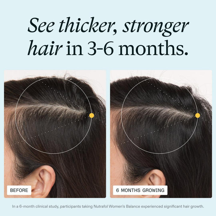 Nutrafol Women's Balance 45+ Clinically Proven Hair Growth Supplement