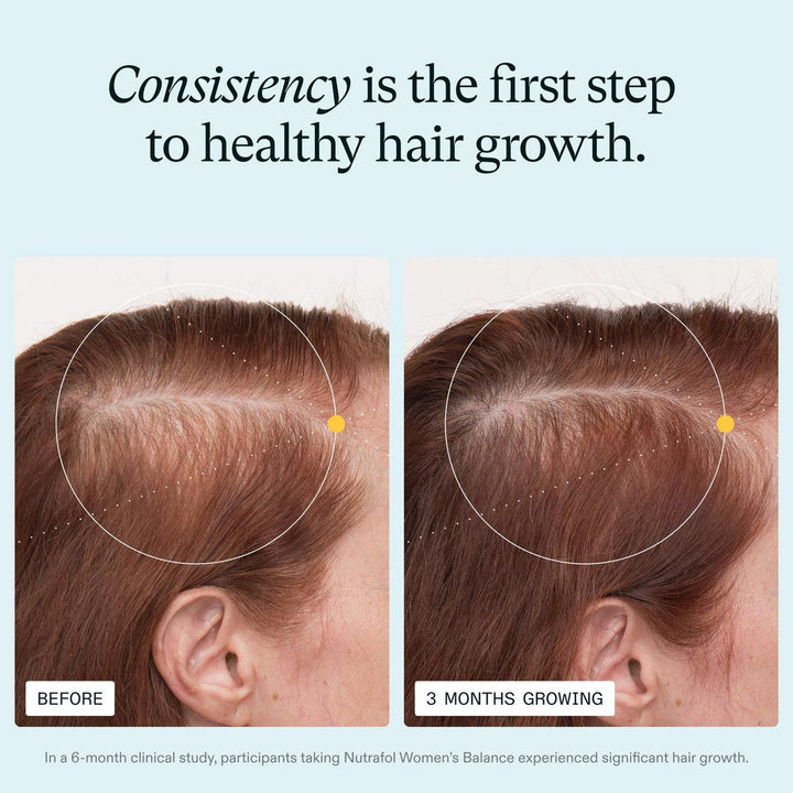 Nutrafol Women's Balance 45+ Clinically Proven Hair Growth Supplement