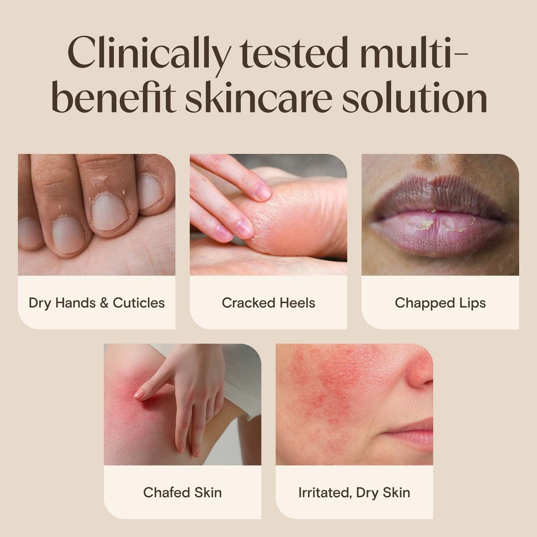 Aveeno Skin Relief Healing Ointment