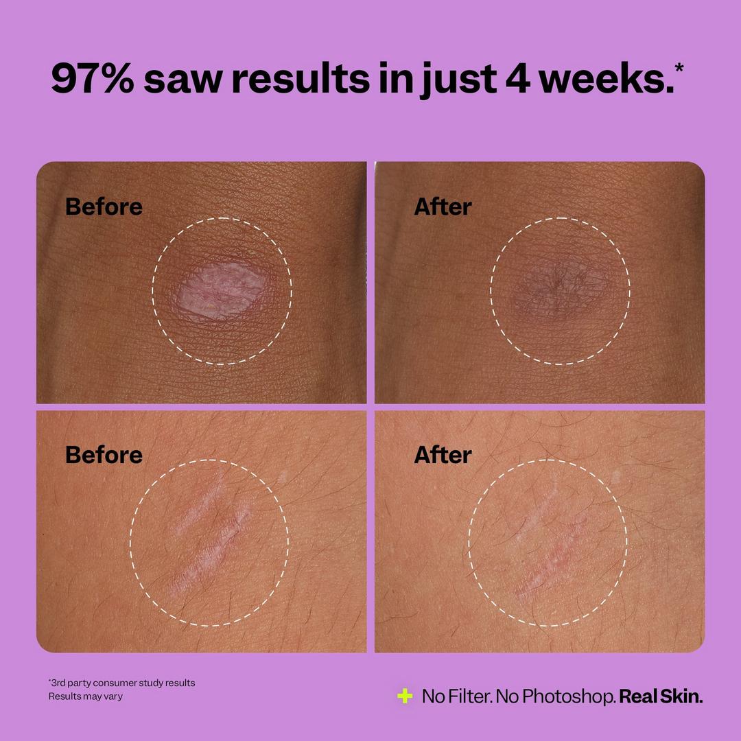Peach Slices Scar Remedy Silicone Gel