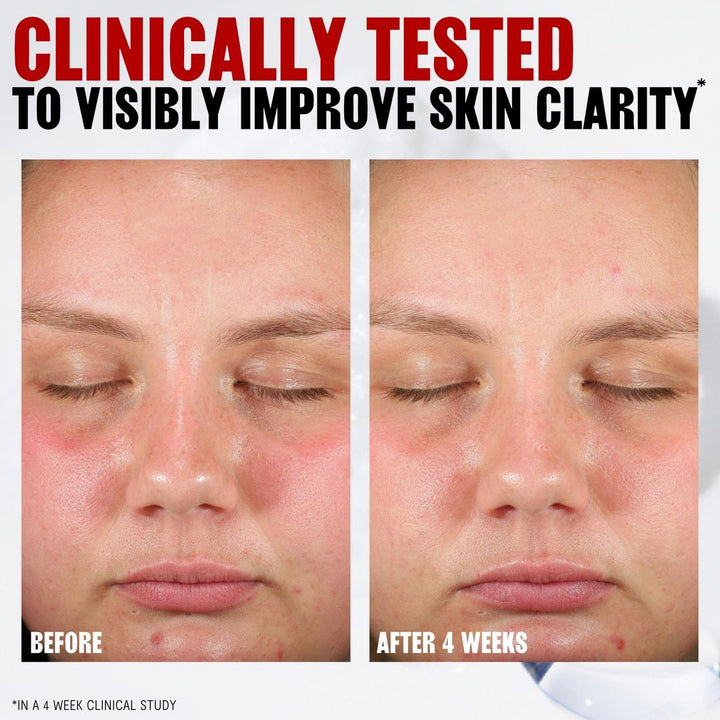 Thayers Pore Refining Pads with Salicylic Acid