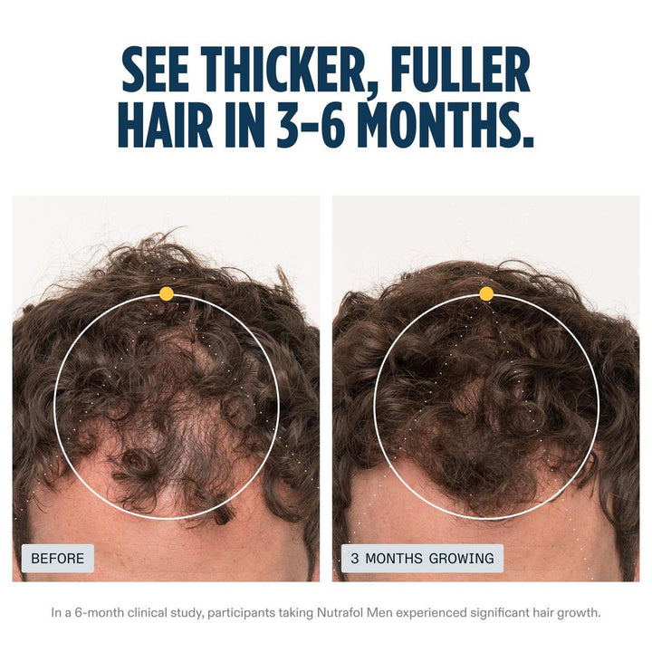 Nutrafol Men's Clinically Proven Hair Growth Supplement