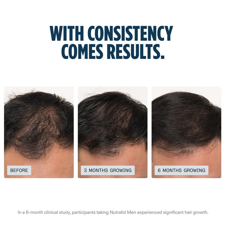 Nutrafol Men's Clinically Proven Hair Growth Supplement