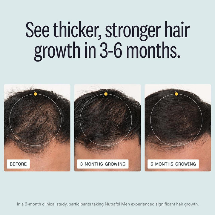 Nutrafol Men Daily Hair Health Routine Set