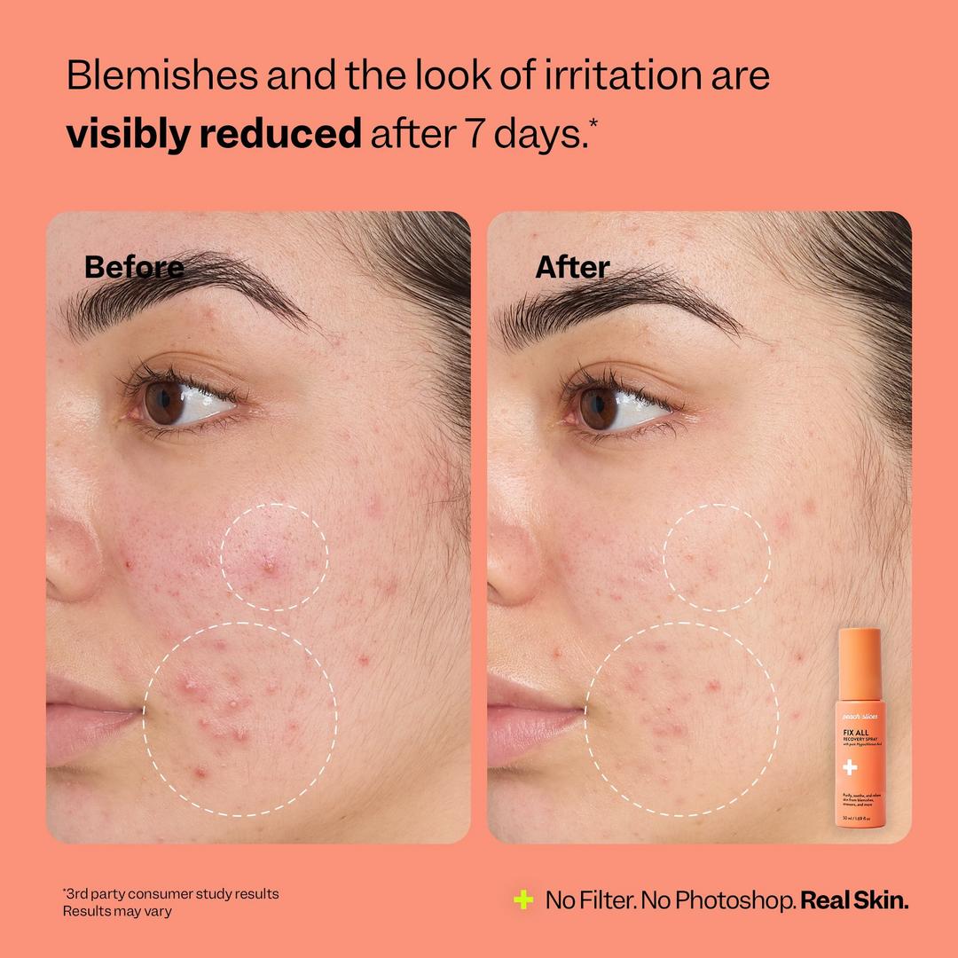 Peach Slices On-The-Glow Treatment Trio 3-Piece Skincare Set