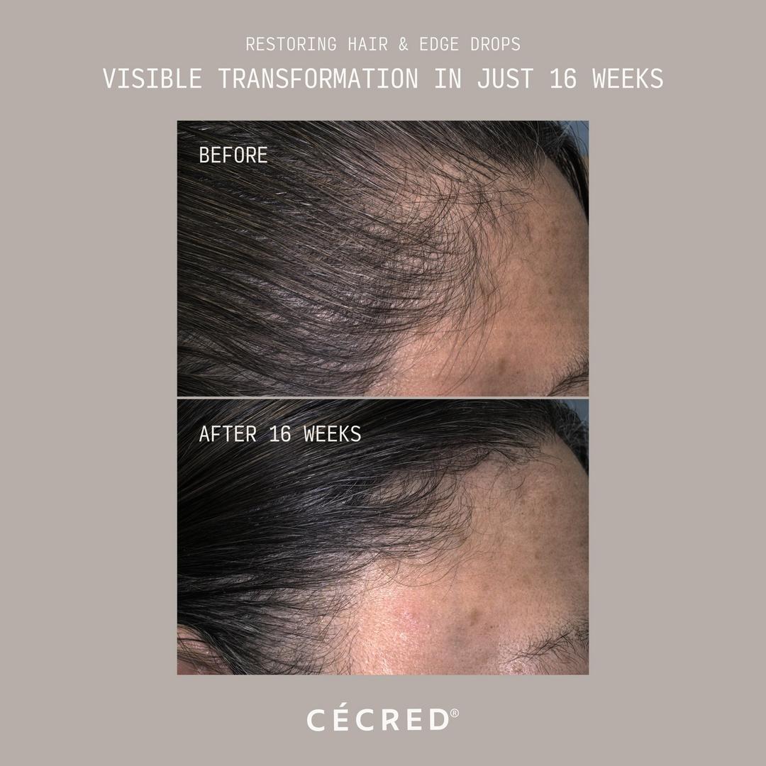 Cécred Restoring Hair & Edge Drops XL Hair Density Serum