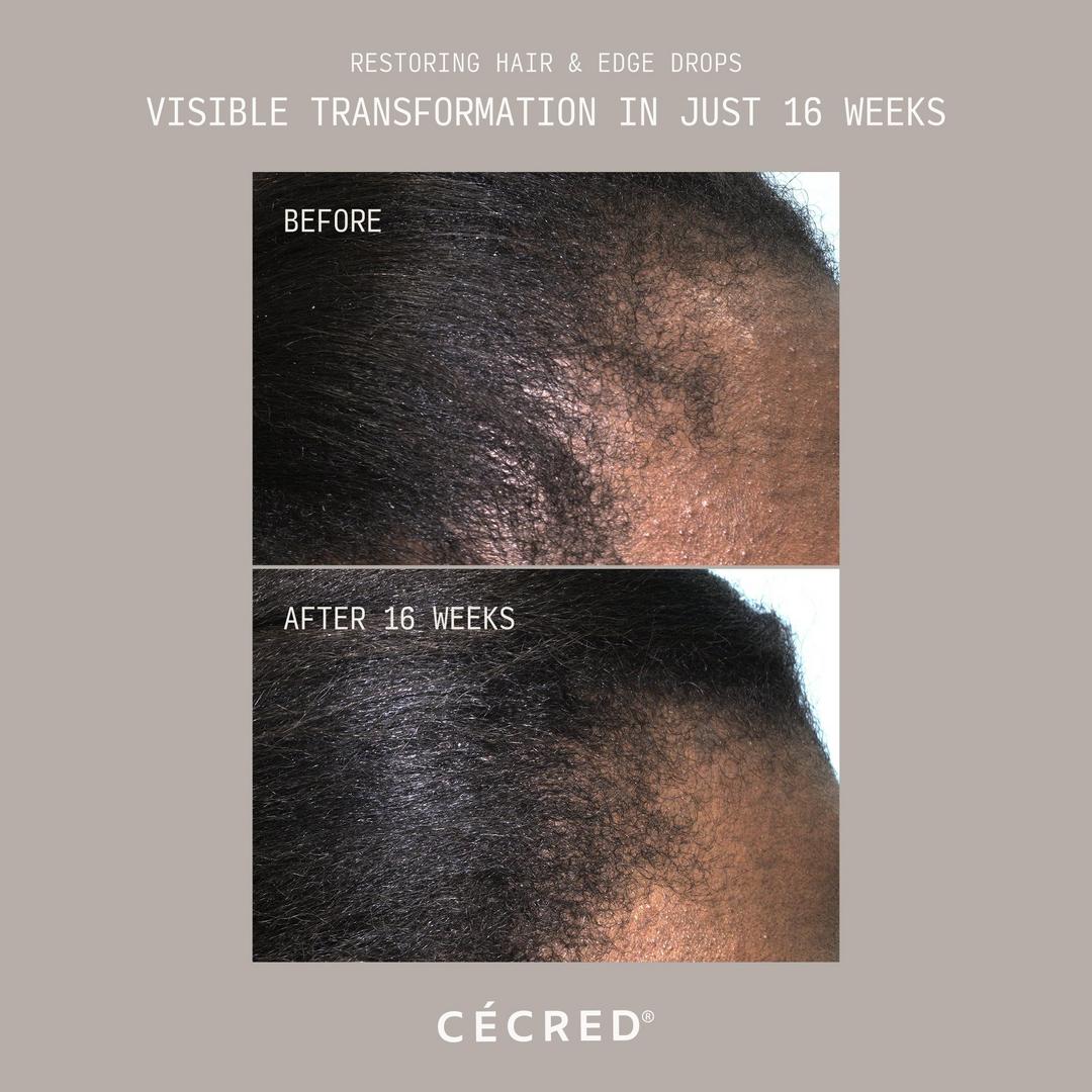 Cécred Restoring Hair & Edge Drops XL Hair Density Serum