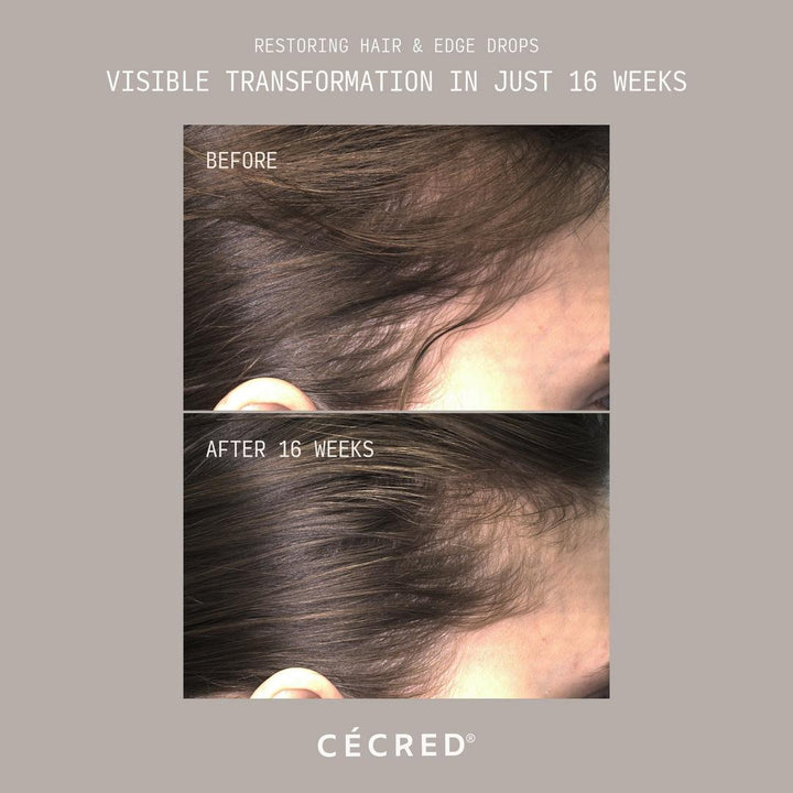 Cécred Restoring Hair & Edge Drops XL Hair Density Serum