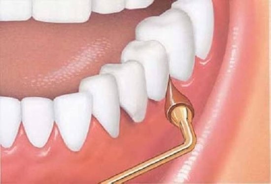 GUM - Stimulator Permanente handgreep en rubberen punt