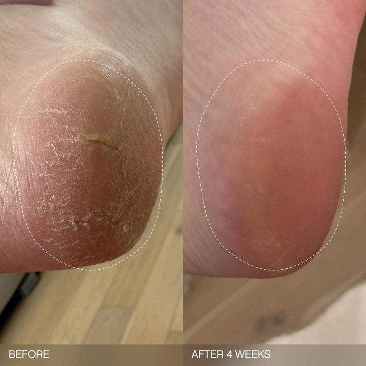 Topicals Slather Exfoliating & Smoothing Bar