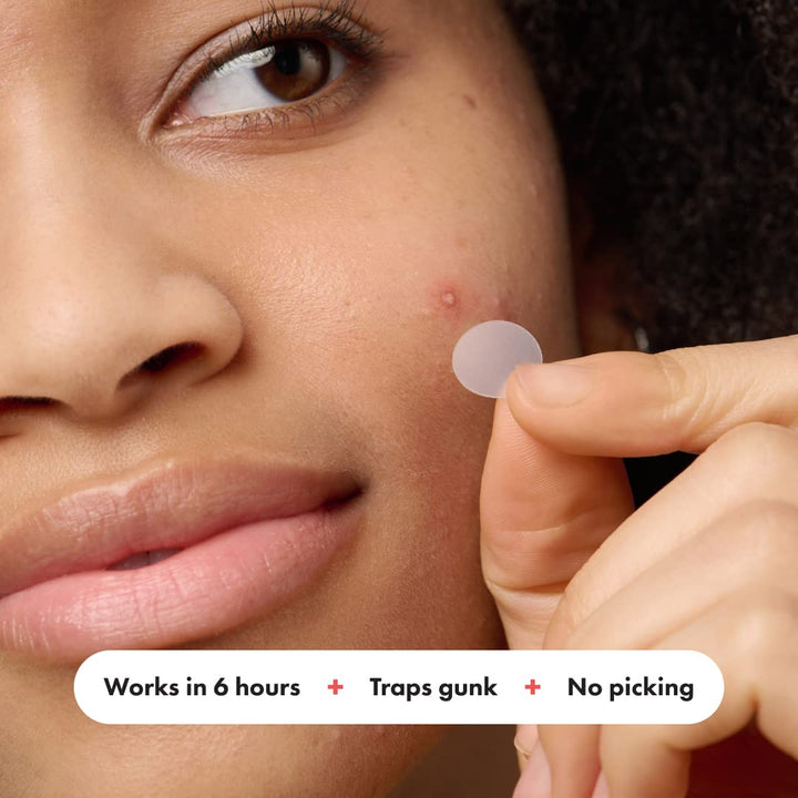 Hero Cosmetics - Mighty Patch Original Acne Pimple Patches - 72 pleisters