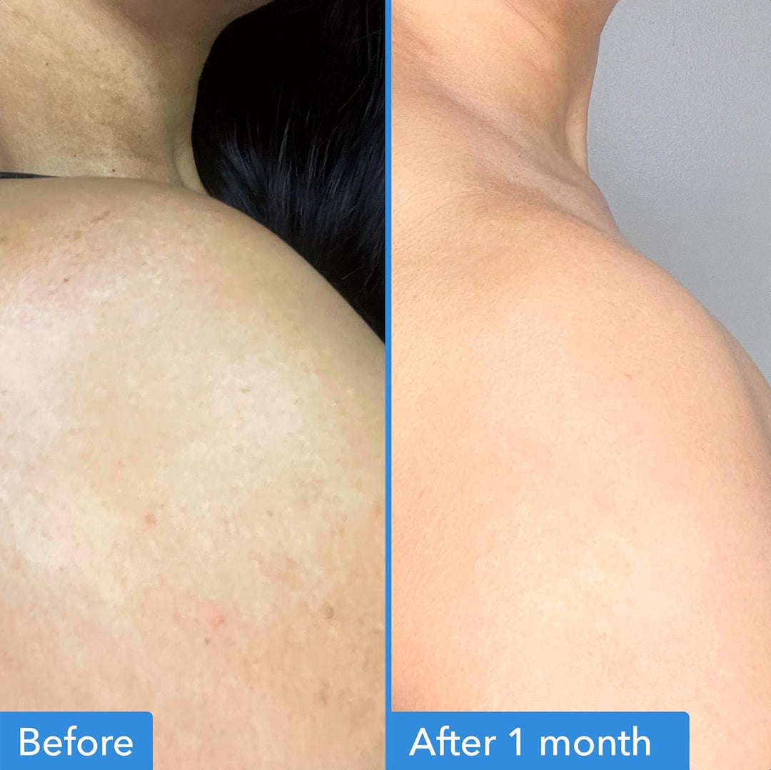 Good Molecules Discoloration Correcting Body Treatment
