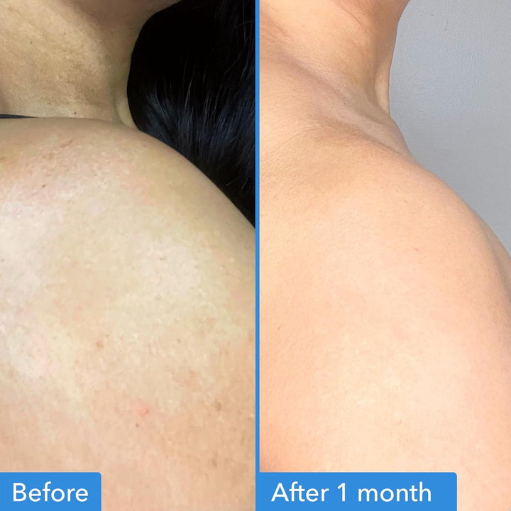Good Molecules Discoloration Correcting Body Treatment