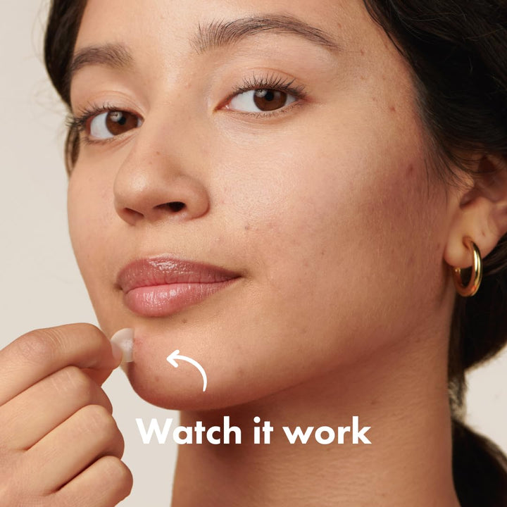 Hero Cosmetics - Mighty Patch Original Acne Pimple Patches - 72 pleisters