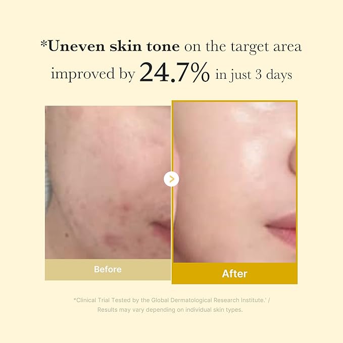 Medicube - Turmeric Overnight Wrapping Peel Off Mask