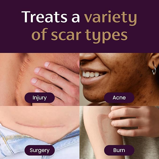 Mederma - Scar Cream Plus SPF 30 -  Sun Damage, Reduces the Appearance of Scars