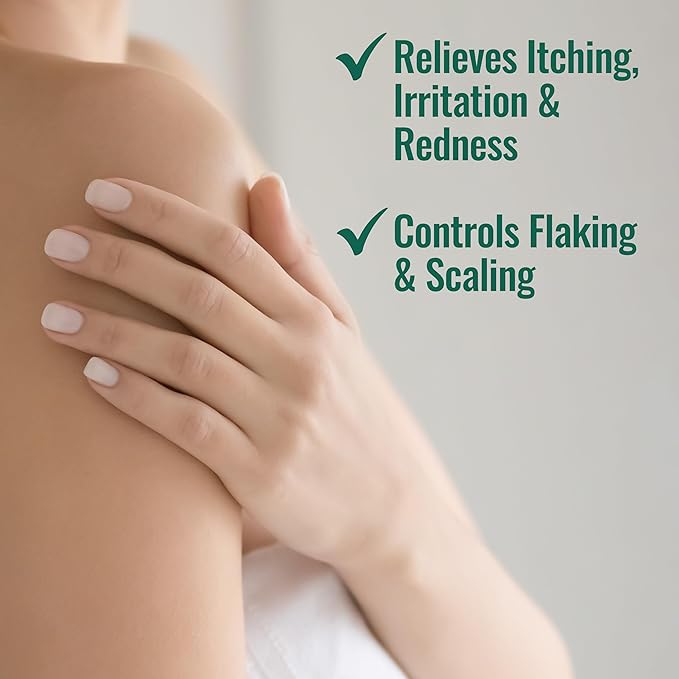 Nizoral - Psoriasis Verlichting Crème - 118ml