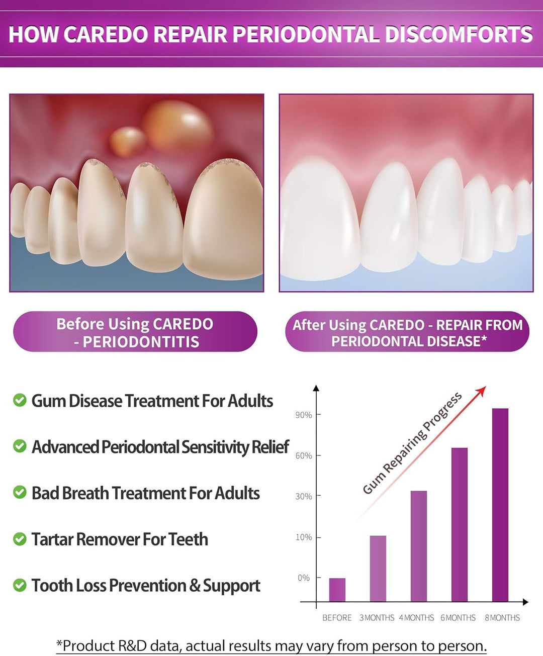Caredo Gum Toothpaste for Periodontitis & Receding Gums