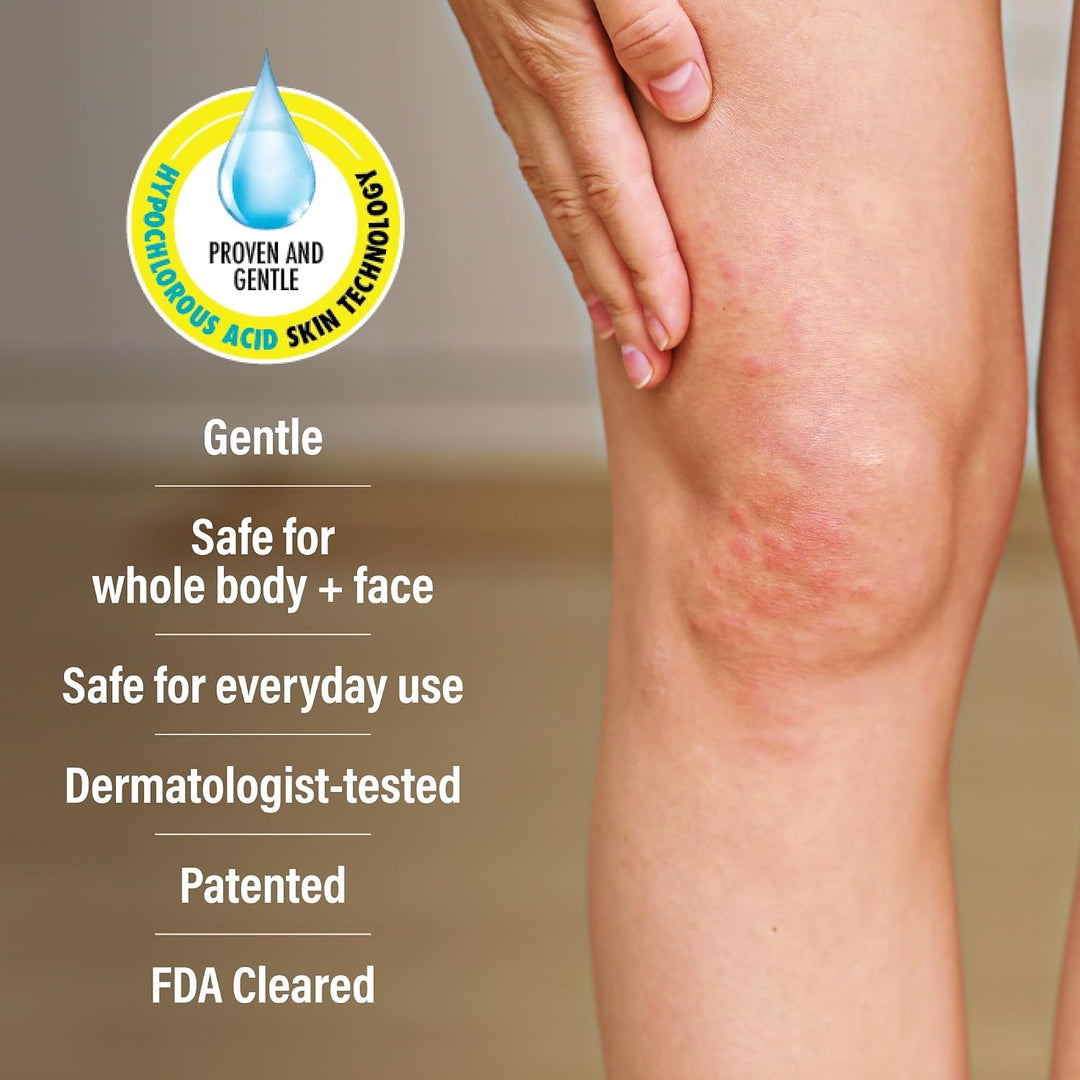 A+D Advanced Dermatitis Hypochlorous Acid Spray