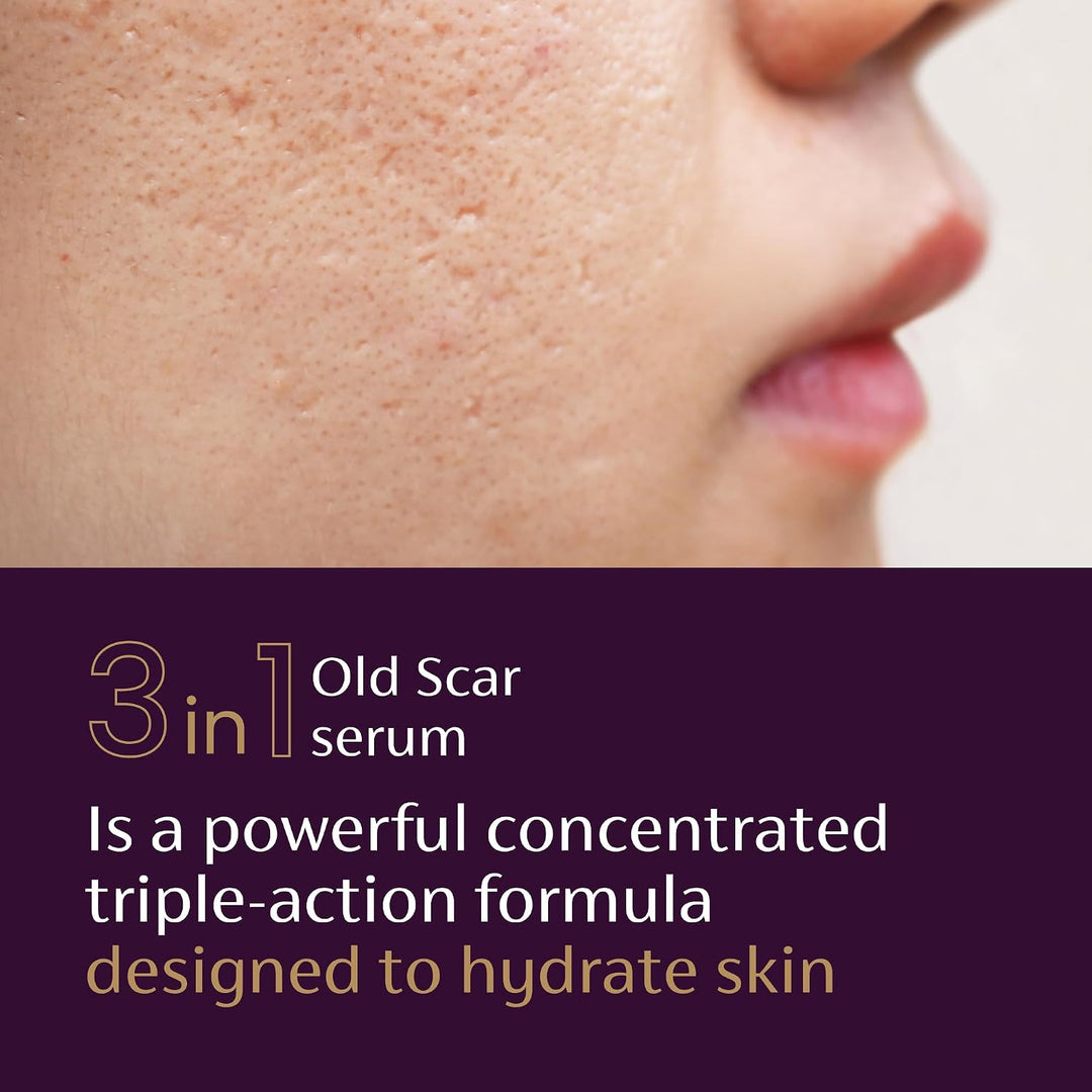 Mederma Scar Serum for Old Scars with Niacinamide