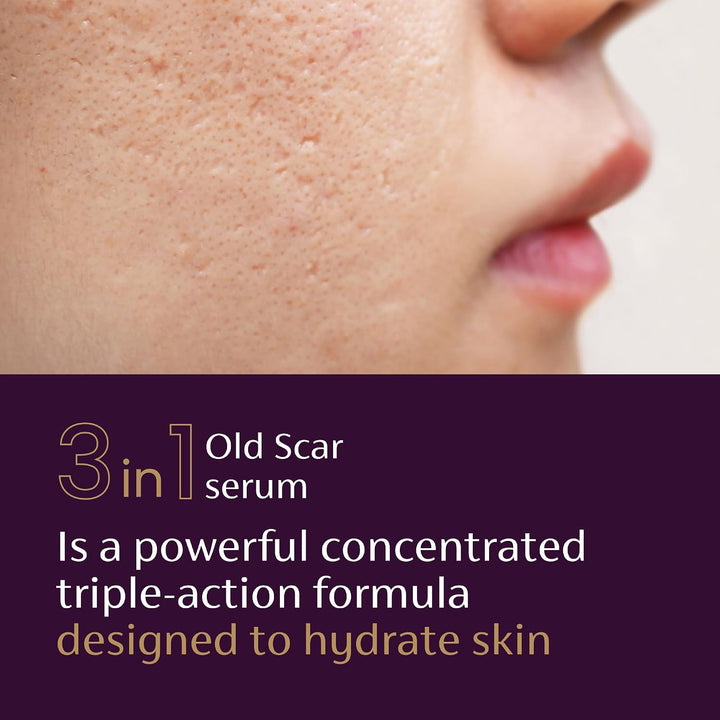 Mederma Scar Serum for Old Scars with Niacinamide