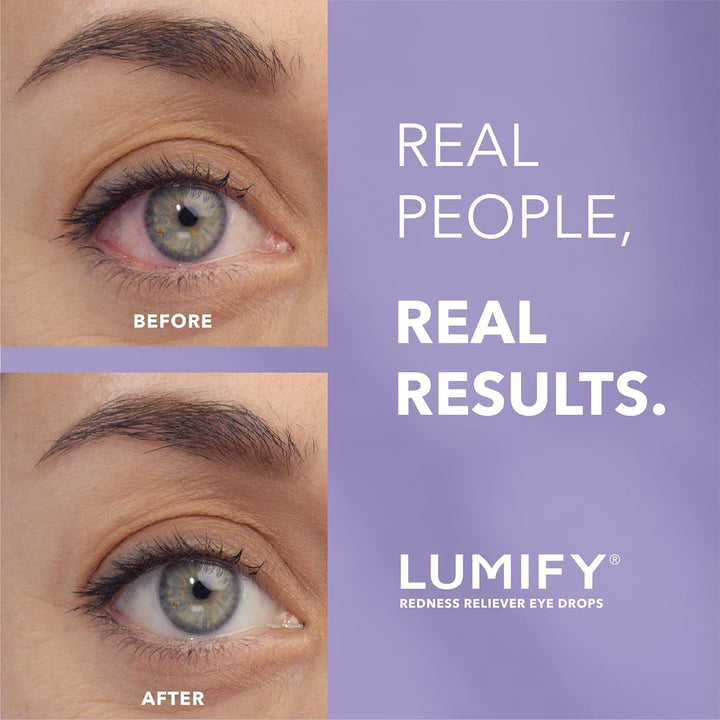 Lumify - Bausch + Lomb - Oogdruppels Tegen Hooikoorts - Rode Ogen - Geïrriteerde Ogen - 2.5ml