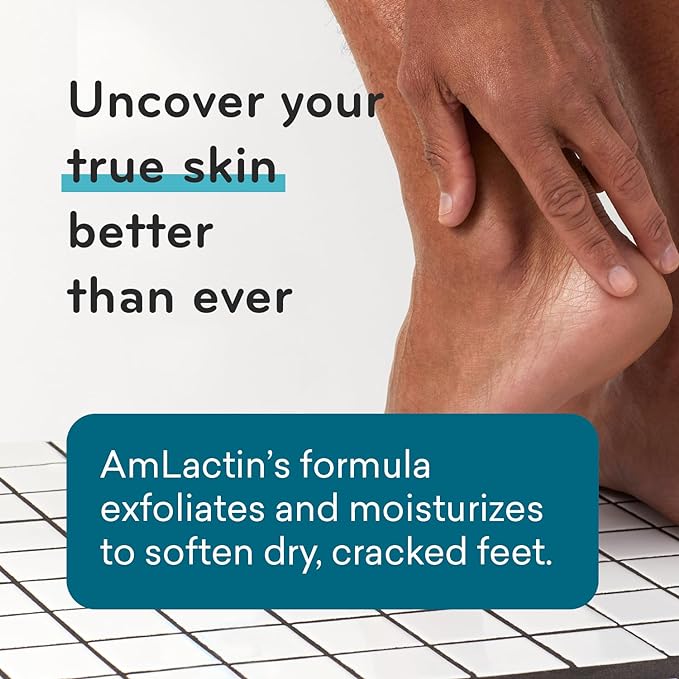 AmLactin - Foot Repair Cream with 15% Lactic Acid AHA - 85g