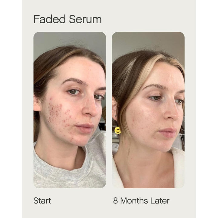 Topicals Faded Starter Kit - The Brightening & Clearing Bundle