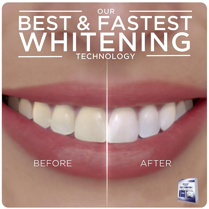 Crest 3D Whitestrips + LED Light Teeth Whitening Kit