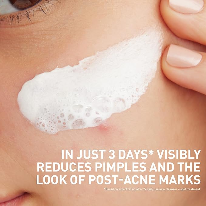 CeraVe Acne Clay-to-Foam Facial Cleanser